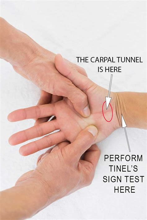 carpel tunnel compressions test grades|hand elevation test for carpal tunnel.